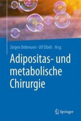 Könyv Adipositas- und metabolische Chirurgie Jürgen Ordemann