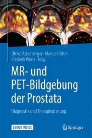 Książka MR- und PET-Bildgebung der Prostata Ulrike Attenberger