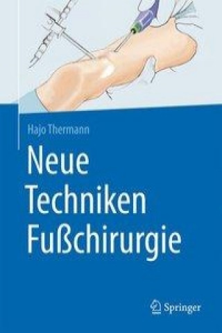 Kniha Neue Techniken Fuchirurgie Hajo Thermann