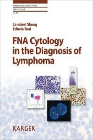 Könyv FNA Cytology in the Diagnosis of Lymphoma E. Tani