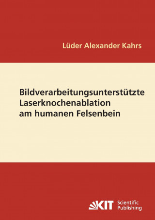 Könyv Bildverarbeitungsunterstutzte Laserknochenablation am humanen Felsenbein Lüder Alexander Kahrs