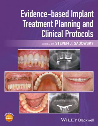 Kniha Evidence-based Implant Treatment Planning and Clinical Protocols Steven J. Sadowsky