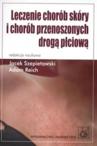 Kniha Leczenie chorob skory i chorob przenoszonych droga plciowa Szepietowski Jacek