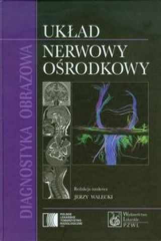 Kniha Diagnostyka obrazowa Uklad nerwowy osrodkowy 