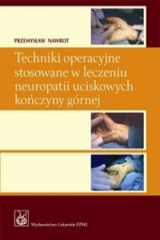 Knjiga Techniki operacyjne stosowane w leczeniu neuropatii uciskowych konczyny gornej z plyta CD Przemyslaw Nawrot