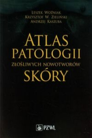 Kniha Atlas patologii zlosliwych nowotworow skory Andrzej Kaszuba