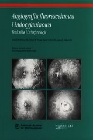Kniha Angiografia fluoresceinowa i indocyjaninowa Joseph W. Berkow