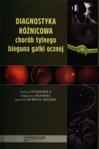 Carte Diagnostyka roznicowa chorob tylnego bieguna galki ocznej Stankiewicz Andrzej