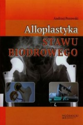 Könyv Alloplastyka stawu biodrowego Andrzej Pozowski