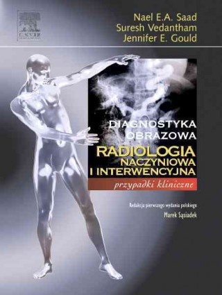 Kniha Radiologia naczyniowa i interwencyjna Nael E. A. Saad
