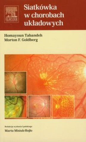 Könyv Siatkowka w chorobach ukladowych Homayoun Tabandeh