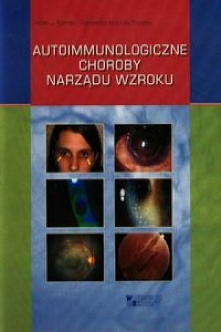 Könyv Autoimmunologiczne choroby narzadu wzroku Kański Jacek J.