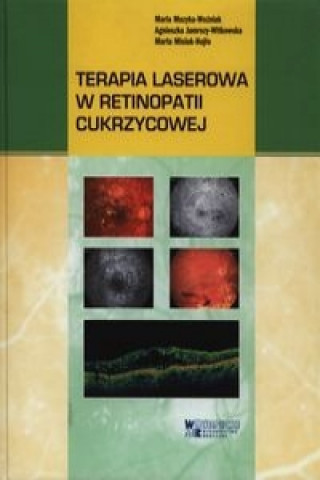 Book Terapia laserowa w retinopatii cukrzycowej Muzyka-Woźniak Maria