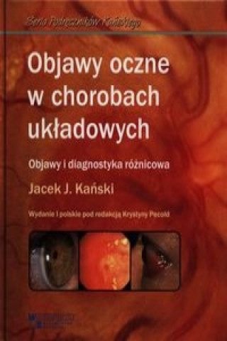 Książka Objawy oczne w chorobach ukladowych Jacek J. Kanski