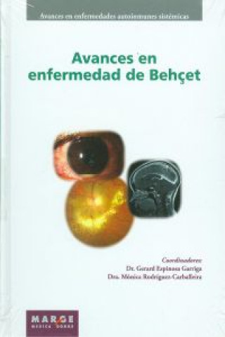 Βιβλίο Avances en enfermedad de Behçet Gerard Espinosa Garriga