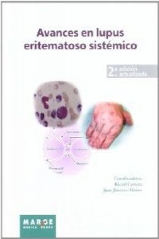 Könyv Avances en lupus eritematoso sistémico Ricard Cervera Segura