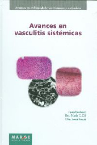 Carte Avances en vasculitis sistemicas MARIA CID