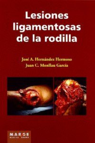 Kniha Lesiones ligamentosas de rodilla José Antonio Hernández Hermoso