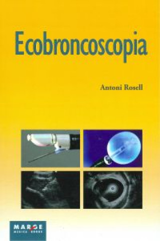 Könyv Ecobroncoscopia ANTONI ROSELL