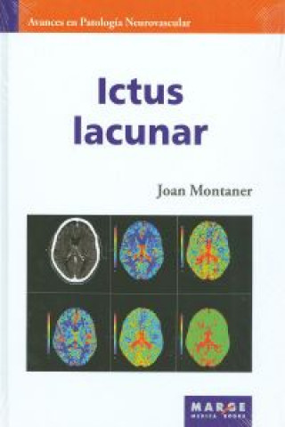 Книга Ictus lacunar JOAN MONTANER