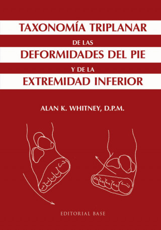 Kniha TAXONOMÍA TRIPLANAR DE LAS DEFORMIDADES DEL PIE 