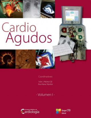 Книга Cardio Agudos, volúmenes I y II 