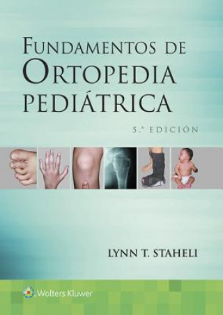 Kniha Fundamentos de ortopedia pediatrica Lynn T. Staheli