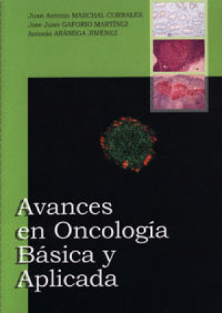 Kniha Avances en oncología básica y aplicada Antonia Aránega Jiménez