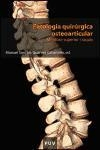 Kniha Patología quirúrgica osteoarticular : membre superior i raquis Carlos Barrios Pitarque