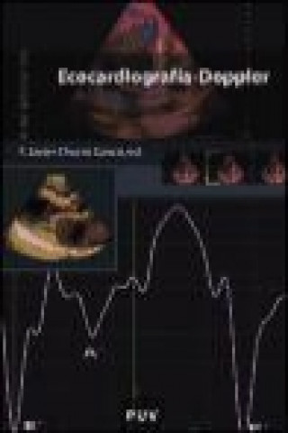 Kniha Ecocardiografía-Doppler 