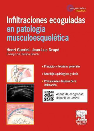 Kniha Infiltraciones ecoguiadas en patología musculoesquelética Jean-Luc Drapé