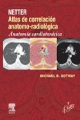 Kniha Netter. Atlas de correlación anatomo-radiológica: Anatomía cardiotorácica MICHAEL B. GOTWAY