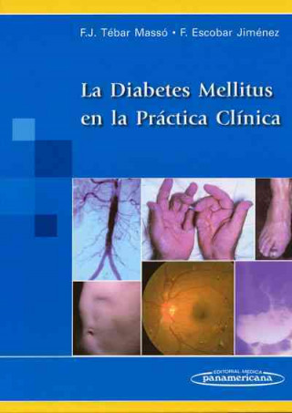 Livre La diabetes en la práctica clínica Francisco Javier Tébar Massó