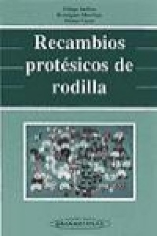 Carte Recambios protésicos de rodilla Gustavo Alonso Carro