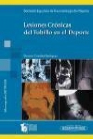 Kniha Lesiones crónicas del tobillo en el deporte Cristóbal Rodríguez Hernández