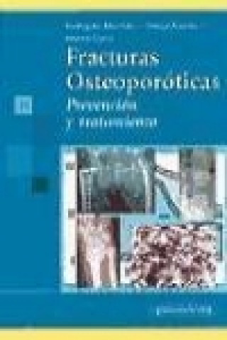 Kniha Fracturas osteoporóticas : prevención y tratamiento Gustavo Alonso Carro