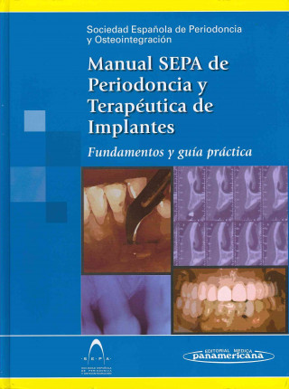 Carte Manual SEPA de periodoncia y terapéutica de implantes. Fundamentos y guía práctica 