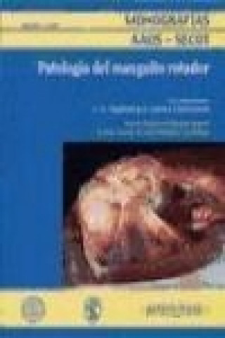 Kniha Patología del manguito rotador 
