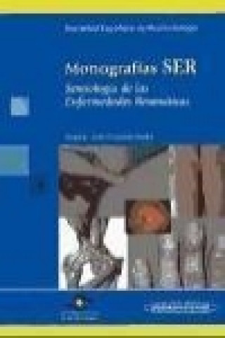 Kniha Semiología de las enfermedades reumáticas Jordi Carbonell Abelló