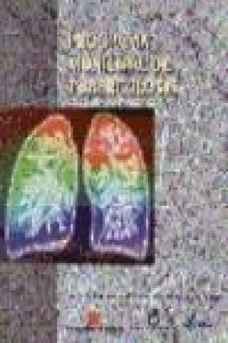 Libro Programa municipal de tuberculosis Dionisio Aranda Rocha
