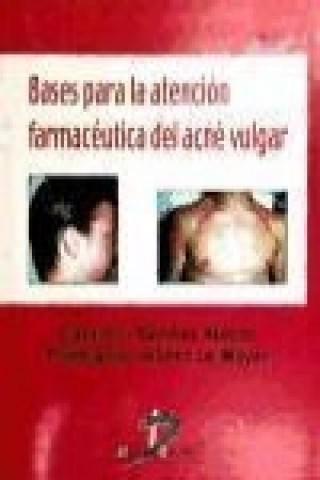 Kniha Bases para la atención farmacéutica del Acne Vulgar Purificación Gómez la Mayor