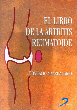 Kniha El libro de la artritis reumatoide Bonifacio Álvarez Lario