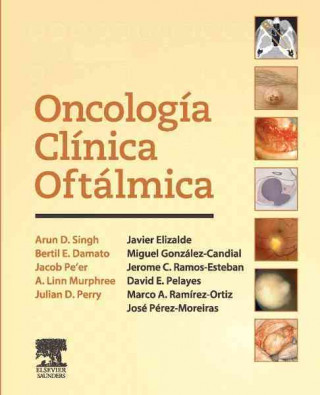 Kniha Oncología clínica oftálmica Arun D. Singh