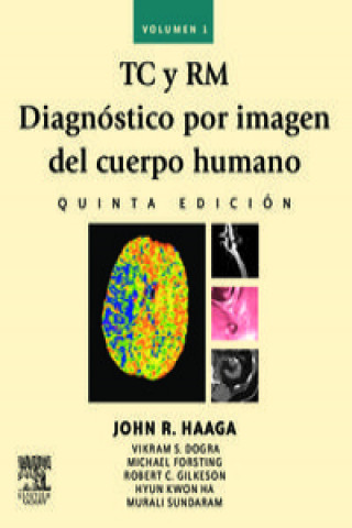 Kniha TC y RM diagnóstico por imagen del cuerpo humano 