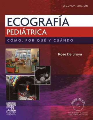 Книга Ecografía pediátrica : cómo, por qué y cuándo Rose de Bruyn