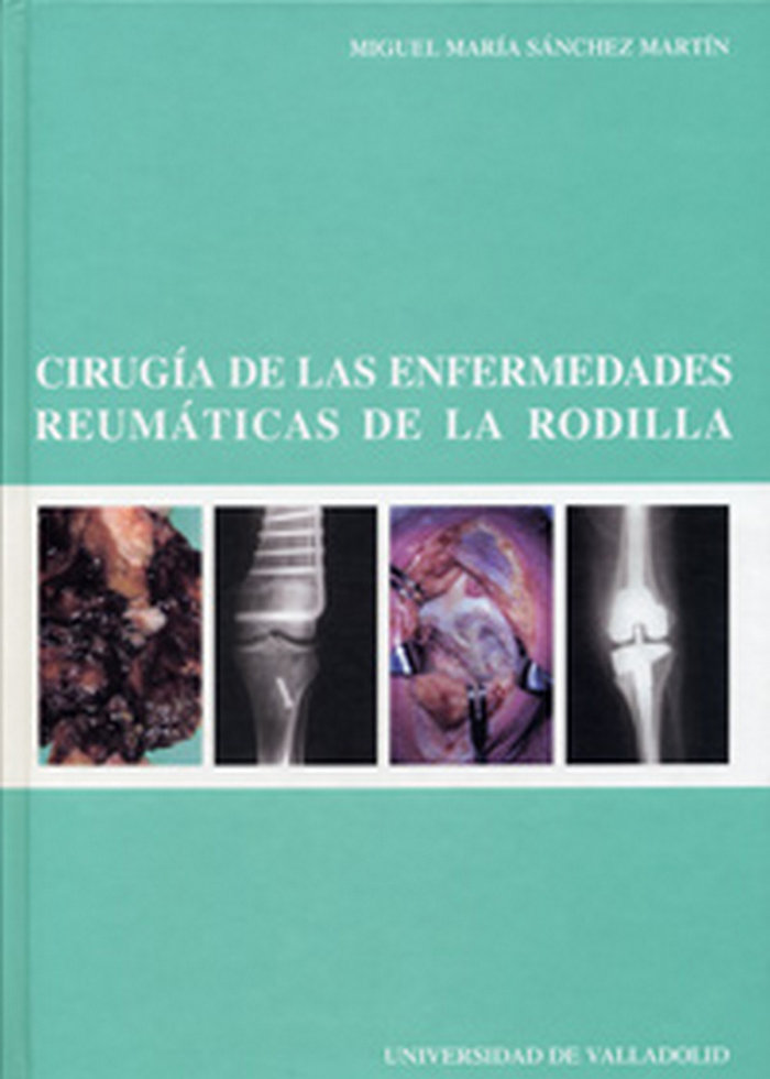 Carte Cirugía de las enfermedades reumáticas de la rodilla Miguel María Sánchez Martín