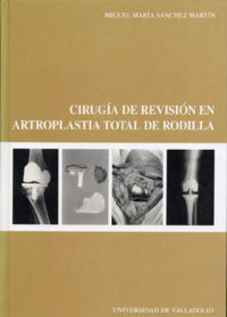 Carte Cirugía de revisión en artroplastia total de rodilla Miguel María Sánchez Martín