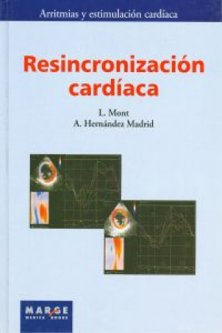 Kniha Resincronización cardíaca JOSEP LLUIS MONT I GIRBAU