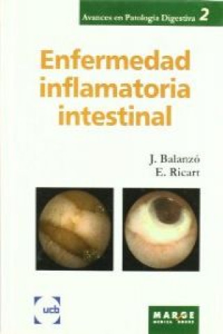 Könyv Enfermedad inflamatoria intestinal Joaquín Balanzó Tintoré