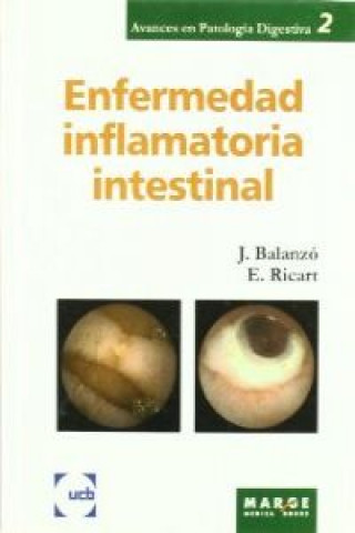 Книга Enfermedad inflamatoria intestinal Joaquín Balanzó Tintoré